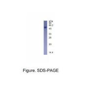 重组SARS-CoV-2 RBD (B.1.617.2.1: K417N蛋白(C-His标签)