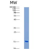 人激活素A受体ⅡB(ACVR2B)重组蛋白His tag