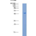 人胎球蛋白B(FETUB)重组蛋白His tag