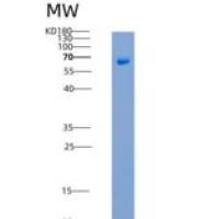 人Decorin / DCN / SLRR1B重组蛋白Fc tag