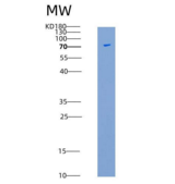 小鼠CD45 / PTPRC重组蛋白aa 453-1152