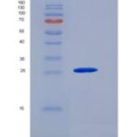 小鼠Syndecan-1 / SDC1 / CD138重组蛋白His tag