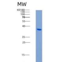 大鼠ACVR1B / ALK-4重组蛋白Fc tag