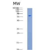 人IL1R2 / CD121b重组蛋白Fc tag