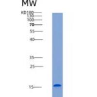 人TNFRSF19 / TROY重组蛋白His tag