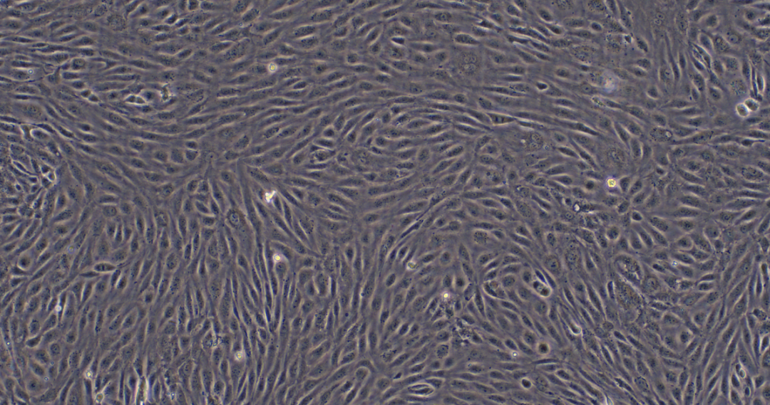 HUVEC 细胞培养攻略 