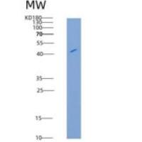大鼠成纤维细胞生长因子受体4(FGFR4)重组蛋白His tag
