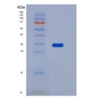 人L选择素(SELL)重组蛋白His Tag