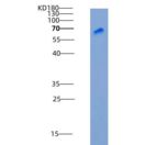 人DC-SIGN / CD209重组蛋白Fc tag