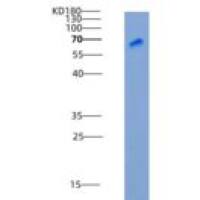 人DC-SIGN / CD209重组蛋白Fc tag