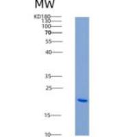 大鼠CD40 / TNFRSF5重组蛋白His tag