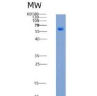 人GFRA3 / GFR-alpha-3重组蛋白His & Fc tag