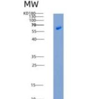 人EphB4 / HTK重组蛋白His tag