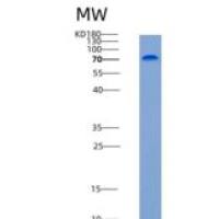 小鼠HER2 / ErbB2 / CD340重组蛋白His tag