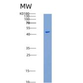 小鼠HVEM重组蛋白His &Fc Tag
