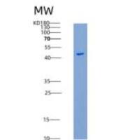 小鼠HVEM重组蛋白His &Fc Tag