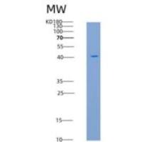 人FAS / CD95 / APO-1 / TNFRSF6重组蛋白Fc tag