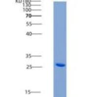 小鼠红细胞生成素受体(EPOR)重组蛋白His tag