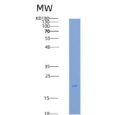 大鼠CD16a / FCGR3A重组蛋白His tag