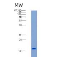 大鼠再生胰岛衍生蛋白3α(REG3a)重组蛋白His tag