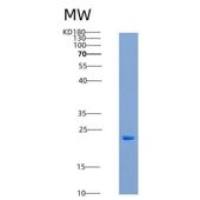 人CMPK1重组蛋白His tag