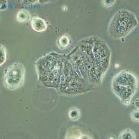 JAK2抑制剂(LY2784544)