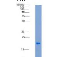 人DMBT1 / Muclin重组蛋白His tag