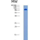 人R-Cadherin / CDH4重组蛋白His tag