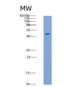 小鼠HVEM重组蛋白His &Fc Tag