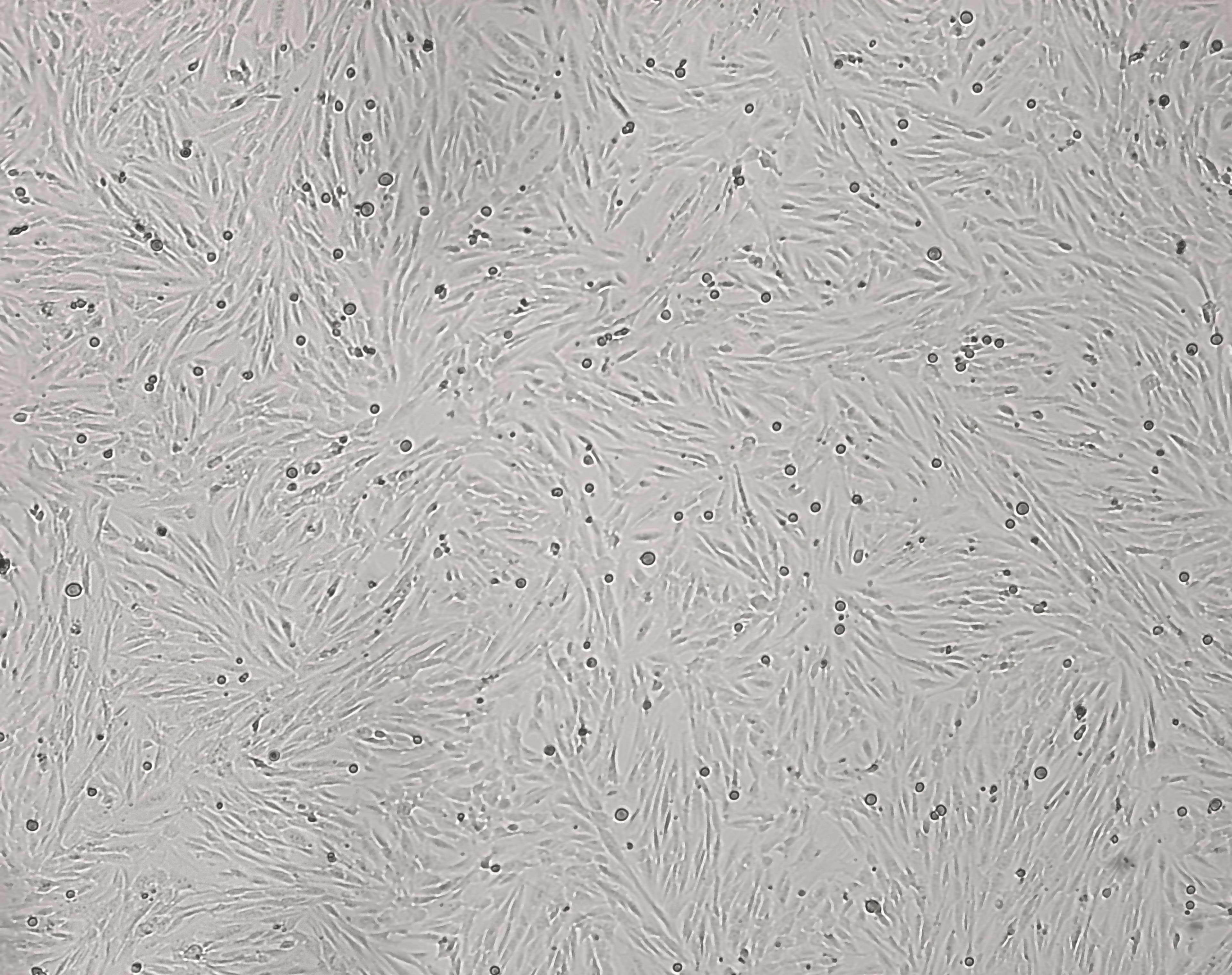 细胞攻略 | HSF(SV40) (人包皮成纤维细胞)培养教程