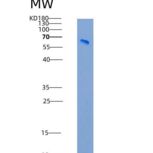 人多巴胺β羟化酶(DbH)重组蛋白His tag