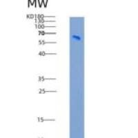 人多巴胺β羟化酶(DbH)重组蛋白His tag