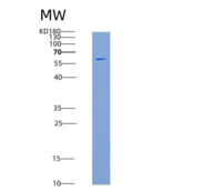 小鼠EphB1 / EPHT2重组蛋白His & GST t