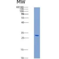 人SP-10 / ACRV1重组蛋白His tag