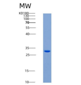 小鼠CLEC10A / MGL1 / CD301重组蛋白Hi
