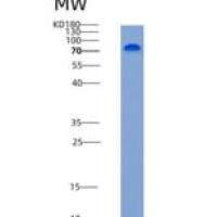 人基底细胞粘附分子(BCAM)重组蛋白Fc tag