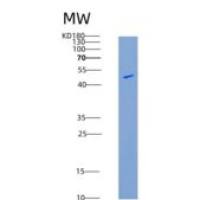 小鼠P4HB / ERBA2L重组蛋白His tag