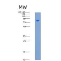 人METAP1重组蛋白Fc tag