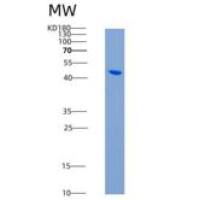 人线粒体肌酸激酶1A(CKMT1A)重组蛋白His tag