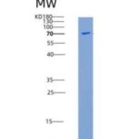 小鼠PDK4重组蛋白His & GST tag