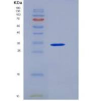 小鼠TNFRSF17 / BCMA重组蛋白Fc tag