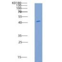 人MMP8 / CLG1重组蛋白His tag