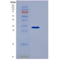 小鼠TNFRSF17 / BCMA重组蛋白His & Fc tag