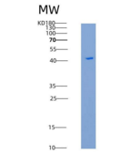 人胎球蛋白B(FETUB)重组蛋白His tag