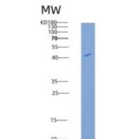 人GFRA3 / GFR-alpha-3重组蛋白His tag