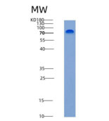 人R-Cadherin / CDH4重组蛋白His tag