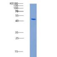 人IFNAR1 / IFNAR重组蛋白His tag