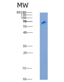 人DC-SIGN / CD209重组蛋白Fc tag