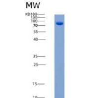 人EphB4 / HTK重组蛋白Fc tag