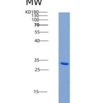 人Ficolin-1 / Ficolin-A / FCN1重组蛋白His tag